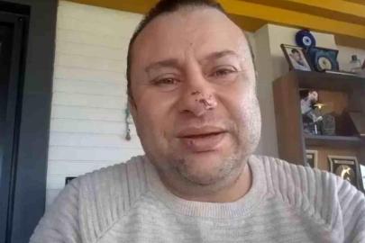 Pitbull saldırısına uğrayan Onur Akay o anları anlattı: "Ben ölümden döndüm"