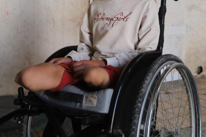 BM: Gazze'de 6 bin 600'den fazla kişi protez veya rehabilitasyon bakımına ihtiyaç duyuyor