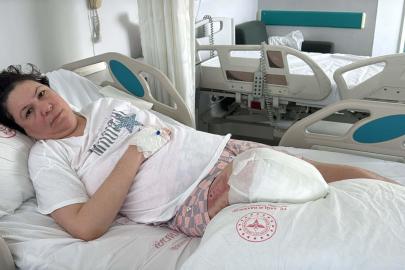 Eşinin saldırısında sol bacağını kaybetmişti; sağ bacağı da ampute edildi